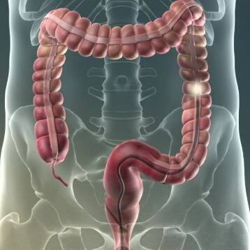 лікар Кабінет Колоноскопії Свято-Михайлівська клінічна лікарня м Києва: опис, відгуки, послуги, рейтинг, записатися онлайн на сайті h24.ua