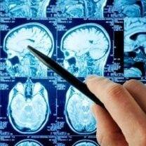 лікар Консультація Нейрохірурга Свято-Михайлівська клінічна лікарня м Києва: опис, відгуки, послуги, рейтинг, записатися онлайн на сайті h24.ua